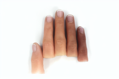 Custom Full-Length Finger Prosthetic – Tailored Size and Skin Color for a Natural Look
